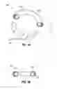 Fig. 02 - SELF-ADJUSTING GASTRIC BAND