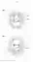 Fig. 03 - Filter switching device for fluorescence endoscopic television camera system