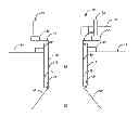 Fig. 01 - Minimally-invasive portal methods for performing lumbar decompression, instrumented fusion/stabilization, and the like