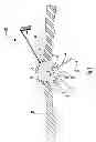 Fig. 02 - Stabilizing Port for Surgery for Facilitating Concurrent Introduction of Multiple Instruments