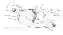 Fig. 01 - Device to detect and treat Apneas and Hypopnea