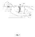 Fig. 08 - Device to detect and treat Apneas and Hypopnea