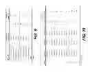 Fig. 09 - S&M TO IDENTIFY A SUBGROUP OF ADHD AT HIGHER RISK FOR COMPLICATING CONDITIONS