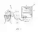 Fig. 02 - NIRS sensor assembly including electrically conductive and optically transparent EMI shielding