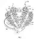 Fig. 02 - Systems and methods to gather and analyze electroencephalographic data