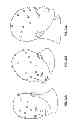 Fig. 22 - Systems and methods to gather and analyze electroencephalographic data