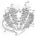 Fig. 01 - Systems and methods to gather and analyze electroencephalographic data