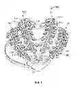 Fig. 02 - Systems and methods to gather and analyze electroencephalographic data