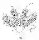 Fig. 04 - Systems and methods to gather and analyze electroencephalographic data