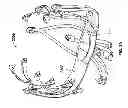 Fig. 32 - Systems and methods to gather and analyze electroencephalographic data