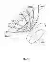 Fig. 41 - Systems and methods to gather and analyze electroencephalographic data