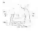 Fig. 01 - Method of detecting signal clipping in a wearable ambulatory medical device
