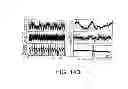 Fig. 09 - Implantable Zero-Wire Communications System