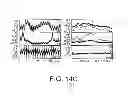 Fig. 10 - Implantable Zero-Wire Communications System