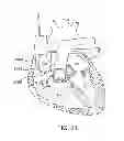 Fig. 16 - Implantable Zero-Wire Communications System