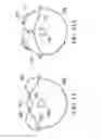 Fig. 10 - RECTAL BALLOON WITH SENSOR CABLE