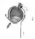 Fig. 04 - Drug delivery device and applications of same