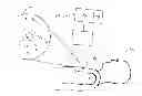 Fig. 01 - Method and apparatus for diagnosis of tumor activity using tumor interstitial fluid pressure