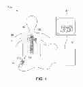 Fig. 04 - ELECTROMAGNETIC INSTRUMENT TRACKING SYSTEM WITH METAL DISTORTION DETECTION AND UNLIMITED HEMISPHERE OPERATION