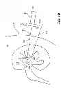 Fig. 03 - PERCUTANEOUS NEPHROLITHOTOMY TARGET FINDING SYSTEM