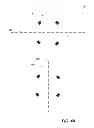 Fig. 06 - PERCUTANEOUS NEPHROLITHOTOMY TARGET FINDING SYSTEM