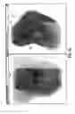 Fig. 10 - LOCALIZATION OF A TARGET USING IN VIVO MARKERS