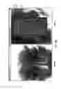 Fig. 11 - LOCALIZATION OF A TARGET USING IN VIVO MARKERS