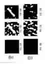 Fig. 13 - LOCALIZATION OF A TARGET USING IN VIVO MARKERS