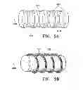Fig. 05 - SUBCUTANEOUS CAVITY MARKING DEVICE AND METHOD