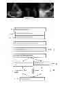 Fig. 02 - Mitral valve detection for transthoracic echocardiography