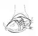 Fig. 01 - Systems and methods for pedal revascularization assessment