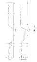 Fig. 08 - Systems and methods for pedal revascularization assessment