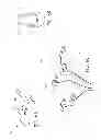 Fig. 10 - Systems and methods for pedal revascularization assessment
