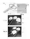 Fig. 14 - Systems and methods for pedal revascularization assessment
