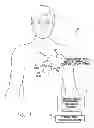 Fig. 02 - Systems and methods for selectively updating cardiac morphology discrimination templates for use with implantable medical devices