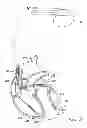Fig. 10 - Systems and methods for selectively updating cardiac morphology discrimination templates for use with implantable medical devices