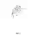 Fig. 03 - Method for analysis of complex rhythm disorders