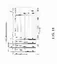 Fig. 15 - Method for analysis of complex rhythm disorders