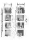 Fig. 16 - Method for analysis of complex rhythm disorders