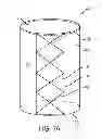Fig. 02 - SPECIMEN REMOVAL BAG AND METHODS OF USING SAME