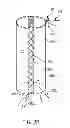 Fig. 05 - SPECIMEN REMOVAL BAG AND METHODS OF USING SAME