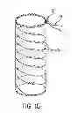 Fig. 09 - SPECIMEN REMOVAL BAG AND METHODS OF USING SAME