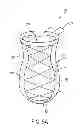 Fig. 10 - SPECIMEN REMOVAL BAG AND METHODS OF USING SAME