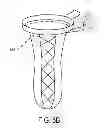 Fig. 11 - SPECIMEN REMOVAL BAG AND METHODS OF USING SAME