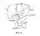 Fig. 20 - SPECIMEN REMOVAL BAG AND METHODS OF USING SAME
