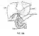Fig. 21 - SPECIMEN REMOVAL BAG AND METHODS OF USING SAME