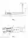 Fig. 04 - Apparatus and methods for removing spring based multiple biopsy specimens from multiple biopsy storage cylinders before and after biopsy fixation and histopathological processing