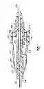 Fig. 02 - Flashback blood collection needle