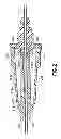 Fig. 03 - Flashback blood collection needle