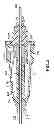 Fig. 04 - Flashback blood collection needle